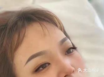 全程睡着就做好了，完全无疼痛的感觉～做完能很清晰的看