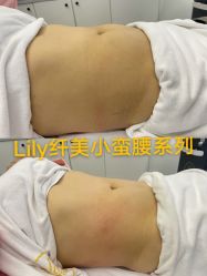 -Lily纤美·科技减脂中心