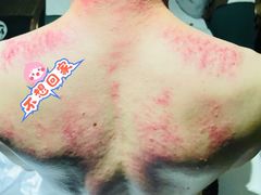 -天然沐足·推背采耳·敷姜艾灸(龙眼美食街店)