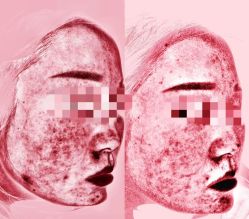 -和颜一美轻医美连锁