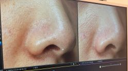 -苑苑vbeauty科技美容SPA