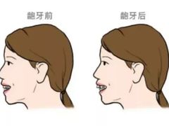 -柏乐口腔(南宁总院)