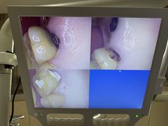 -上海仁爱医院口腔科 · 种植