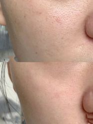 -SKIN79皮肤管理中心