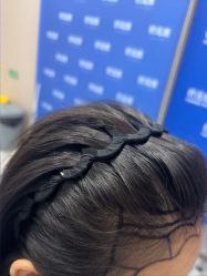 -碧莲盛不剃发植发