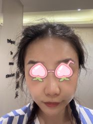 体验后-伊美康医疗美容·抗衰中心