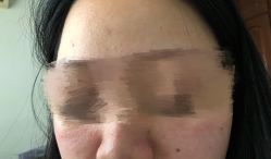 -HUAMEI·华美皮肤中心