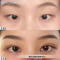 -广西颜白玉医疗美容门诊部