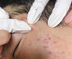 -첫번째 初见美学中心