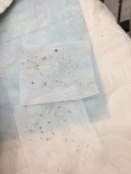 点击看大图 -痘瑞仕·专业祛痘国际连锁