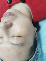 -长沙雅美医疗美容医院