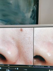 -苑苑vbeauty科技美容SPA