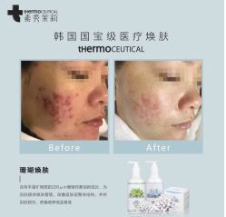 -苗方清颜痘肌研究所