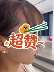 -BR光电保养