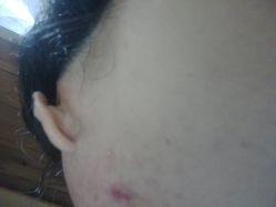 -比华利美容医院