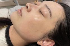 -美安心医美·美迪迈黄金微针·美拉美医疗美容