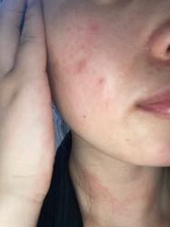 体验前-杭州奥拉克医疗美容门诊部
