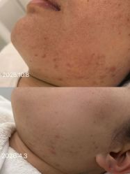 点击看大图 -SOS修丽可.痘肌修复中心