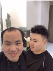 -发饰美男士增发补发假发定制店