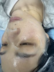 -长沙雅美医疗美容医院