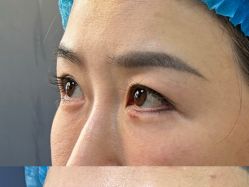 体验前-武汉颜范薇美医疗美容门诊部