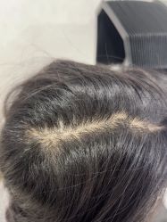 -熙朵美学植发·连锁品牌