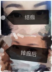 -HQ半永久纹绣纹眉