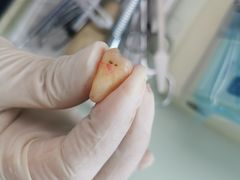 -天使口腔门诊部(上海店)