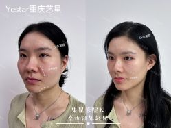-Yestar重庆艺星医疗美容医院