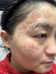 -深圳米兰柏羽医疗美容医院