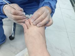 -Andrew指甲专科灰指甲·甲沟炎矫正·3D步态矫形鞋垫定制(浦三路店)