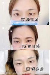 -久匠·纹眉纹绣半永久