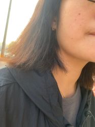 -痣清宫祛斑祛痣连锁店