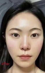 -Yestar艺星医疗美容医院
