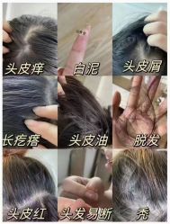 点击看大图 -诗碧曼养发