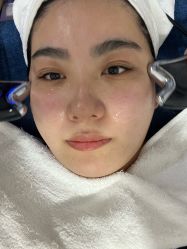 -天津健丽·去眼袋医疗美容机构
