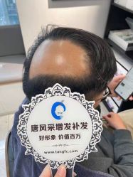 -唐风采假发补发定制