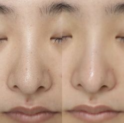 -苗方清颜痘肌研究所