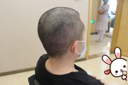 -大麦微针植发丨全国连锁