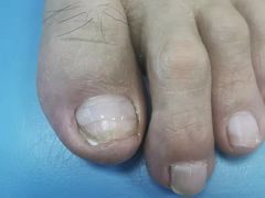 -世龙世家手足健康护理连锁(福田梅林路润裕花园店)