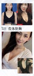 -Yestar艺星医疗美容医院