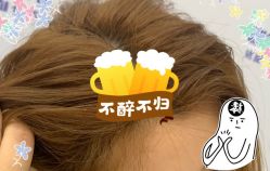 -大麦微针植发全国连锁