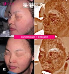 -星港国际·Skin皮肤专研·皮肤管理