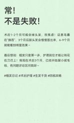-极客侠男士假发定制补发