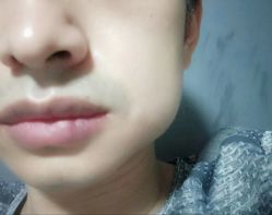 -厦门美莱整形美容医院