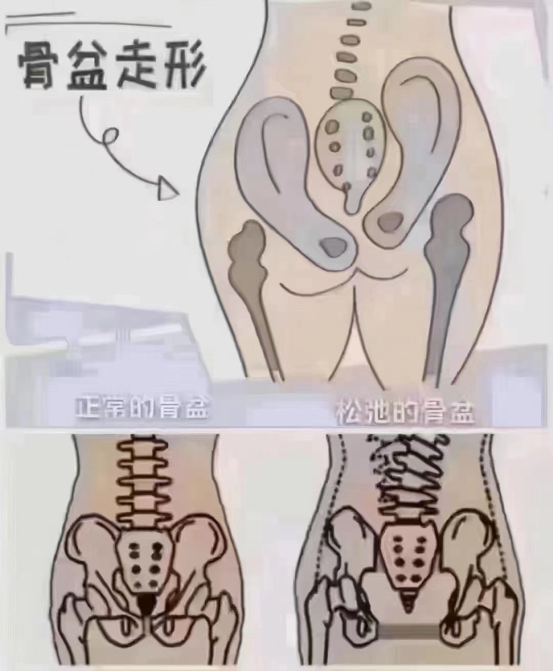 骨盆的秘密