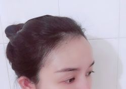 -清颜专业祛痘连锁店