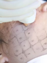 点击看大图 -深圳春天阳光医院·轮廓抗衰中心