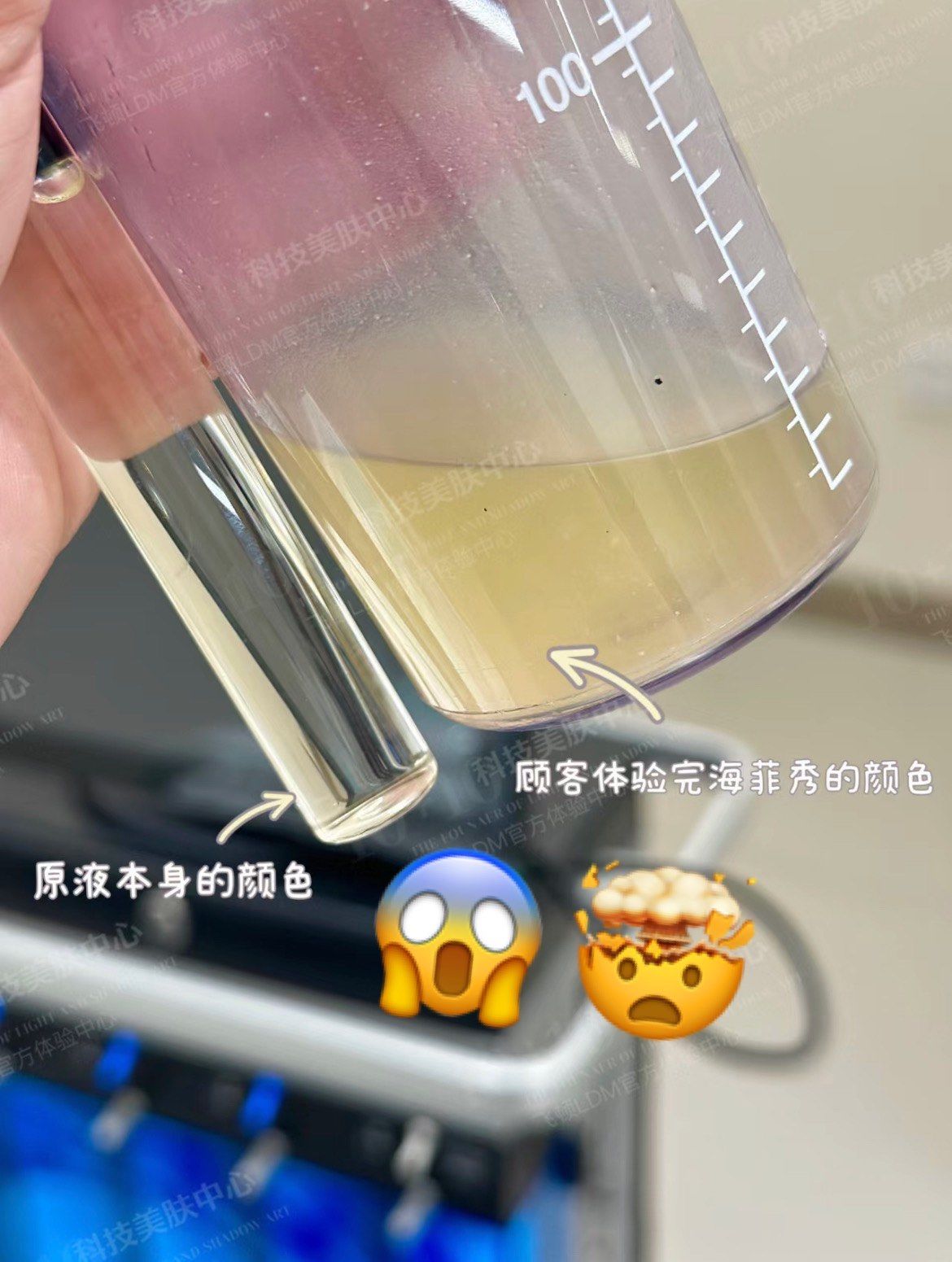 这里有红毯～海菲秀
 小脏水 是如何表达表皮健康指数的?