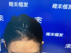 -雍禾植发全国连锁